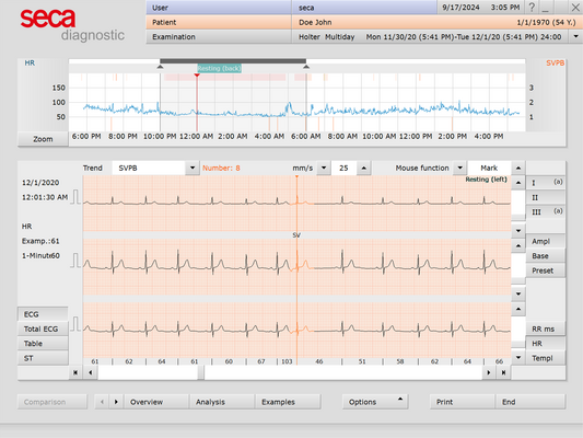 seca Holter Diagnostic-Analysis Software