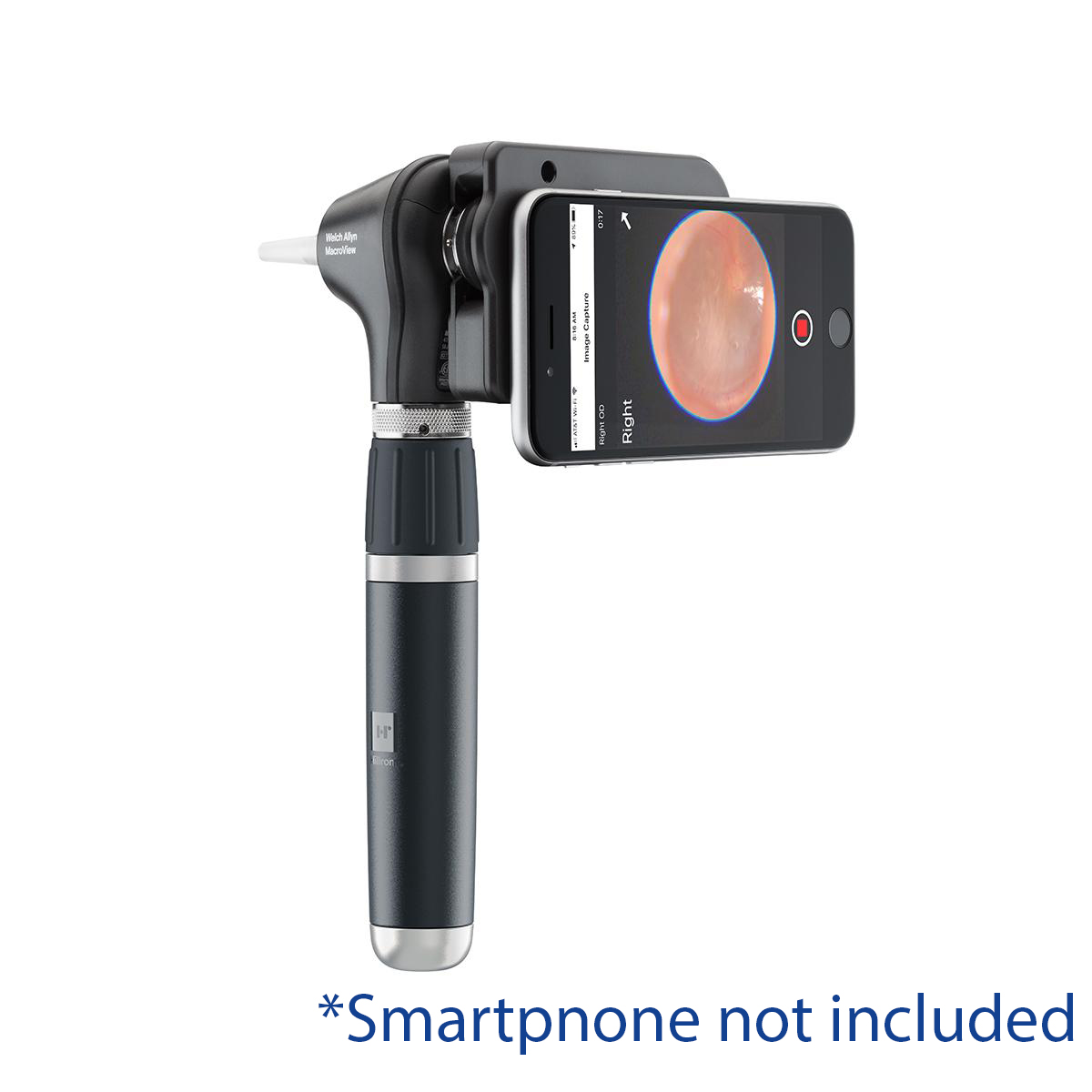 Welch Allyn Macroview Plus iExaminer Otoscope Kit