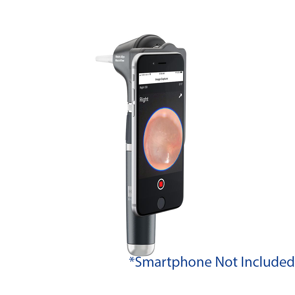 Welch Allyn Macroview Plus iExaminer Otoscope Kit