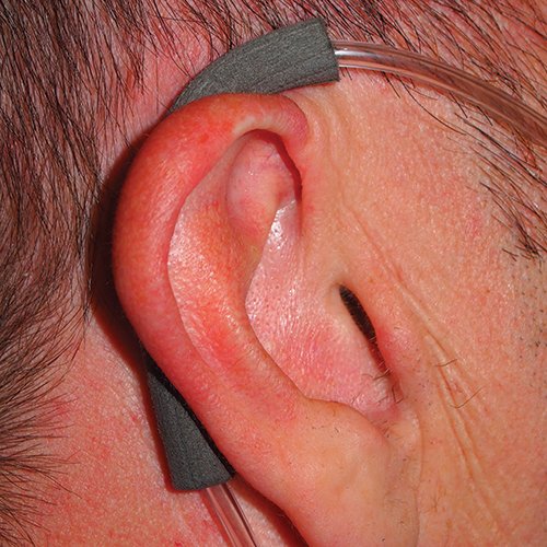 E-Z Wrap Nasal Cannula Protective Pads