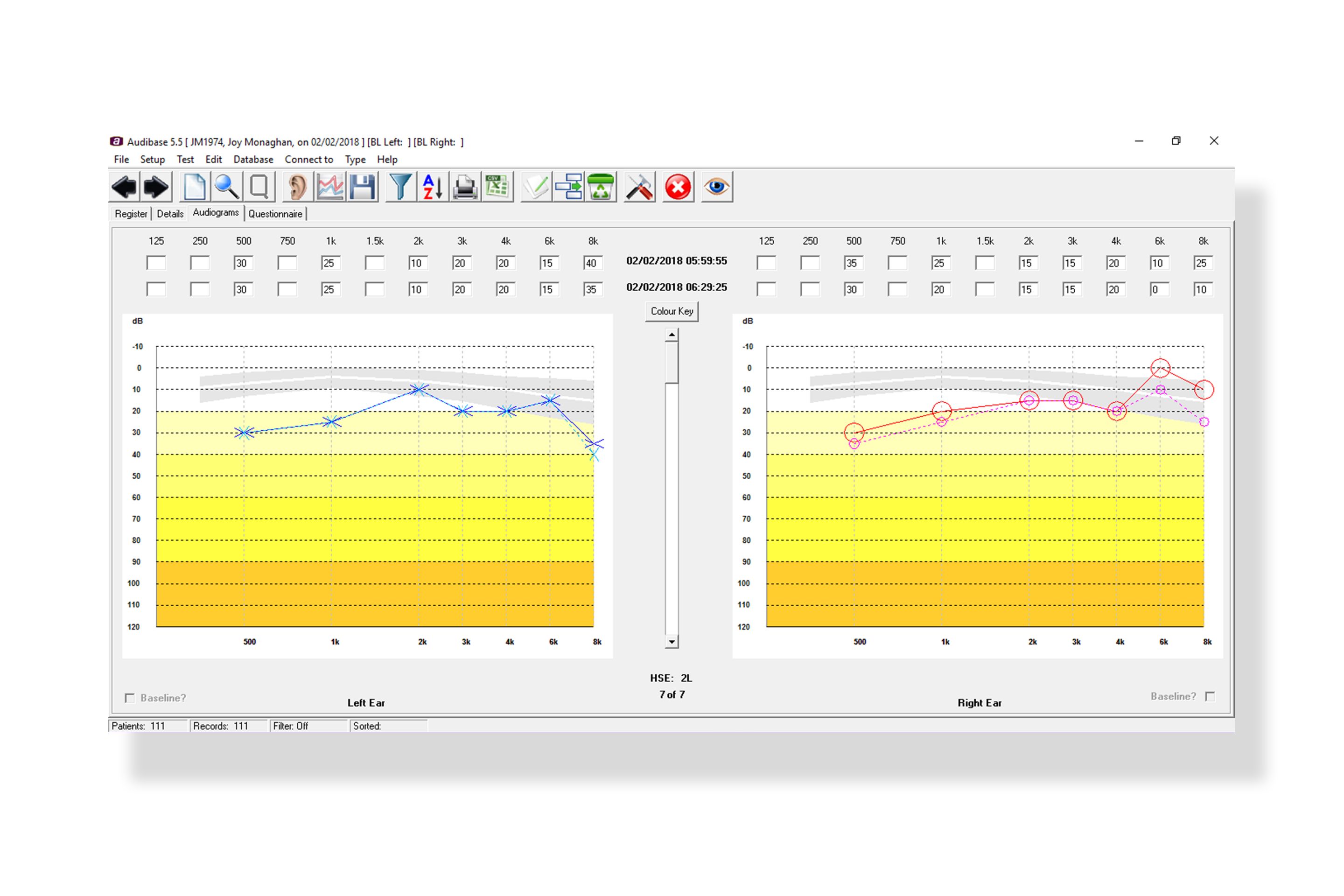 Amplivox Audibase 5.5 Audiometry PC Software
