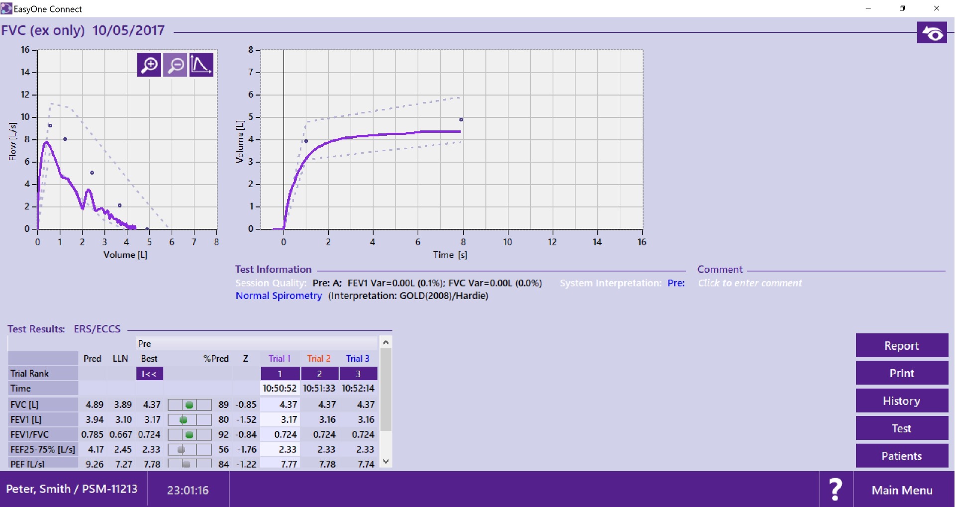ndd Easy on-PC Spirometer Package