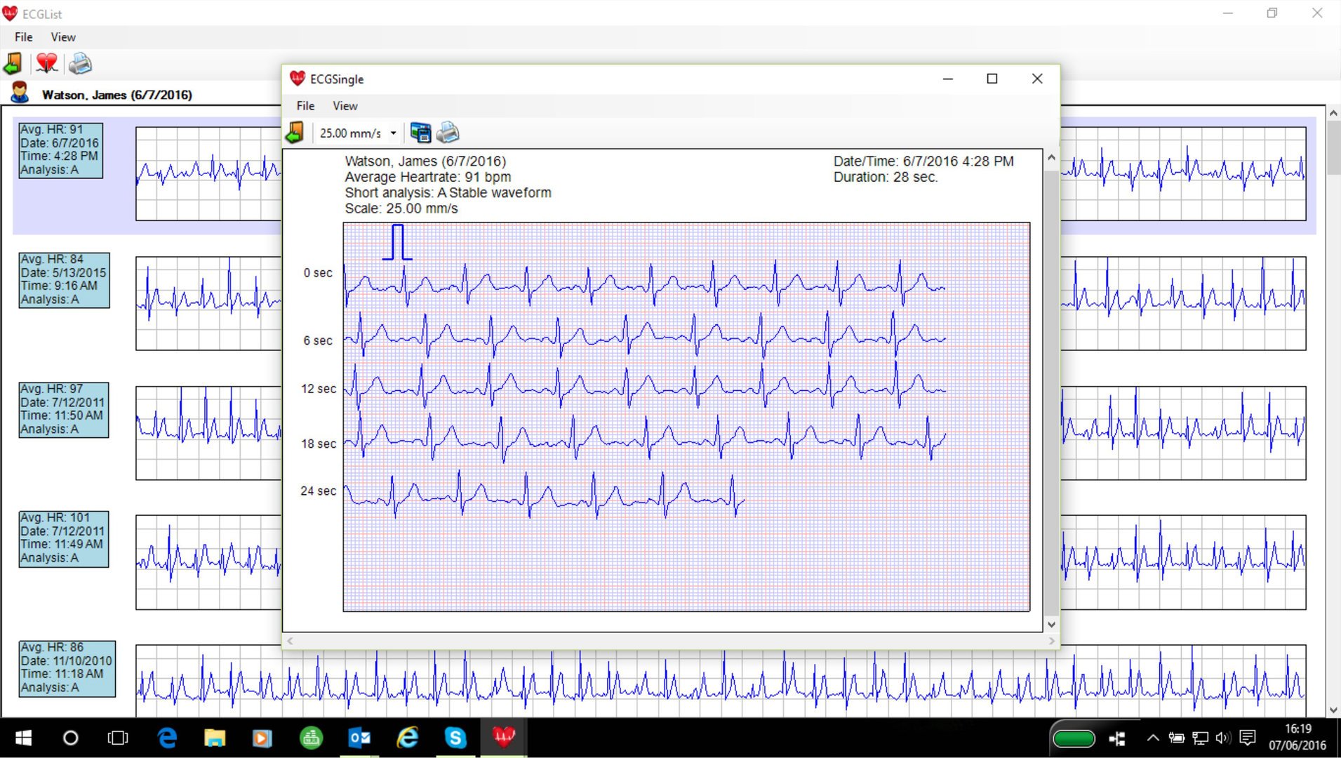 Omron Heartscan Software for ECG