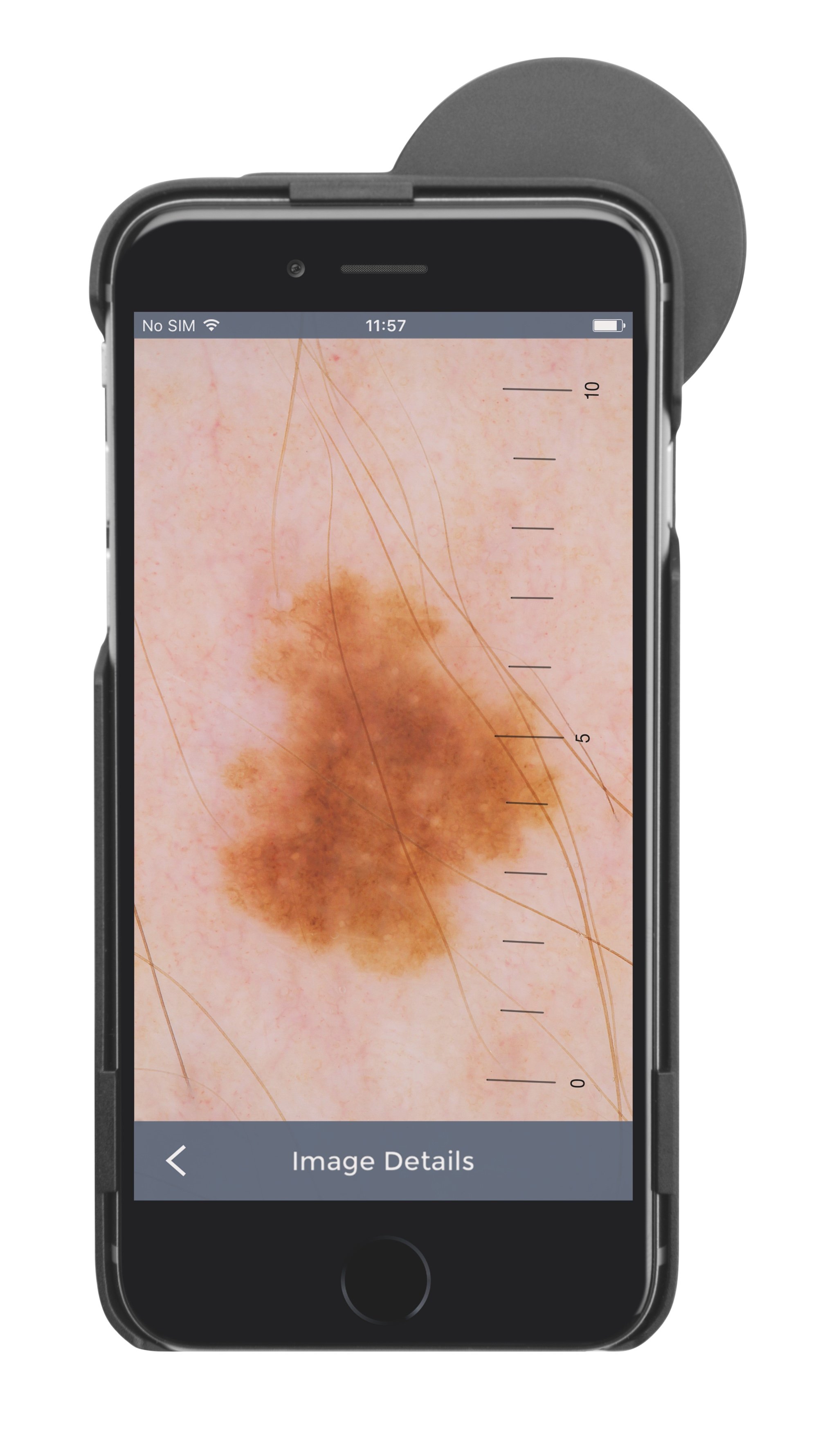 HEINE iC 1 Dermatoscope for iPhone 6/6s