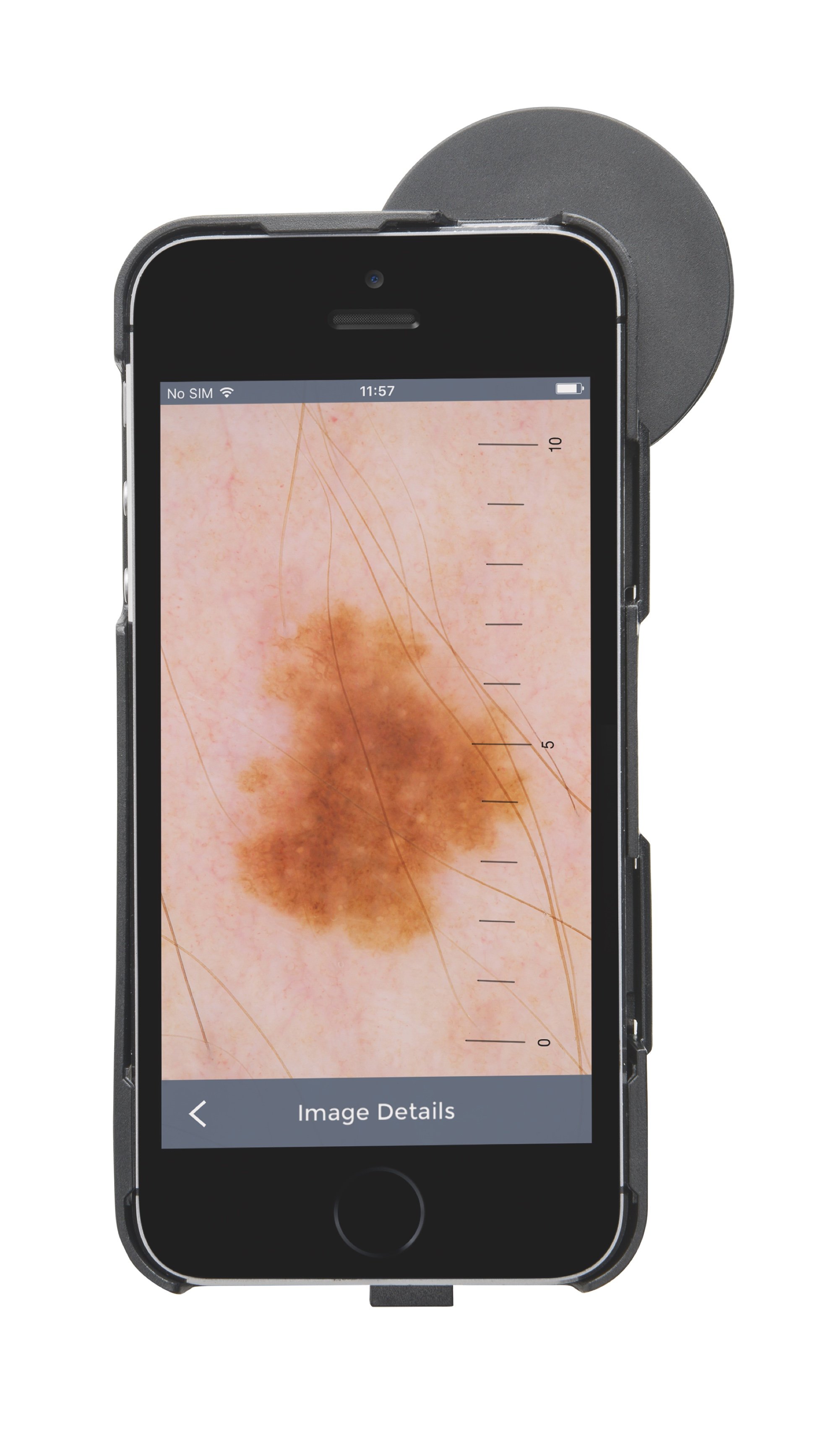 HEINE iC 1 Dermatoscope for iPhone 5/5s/SE