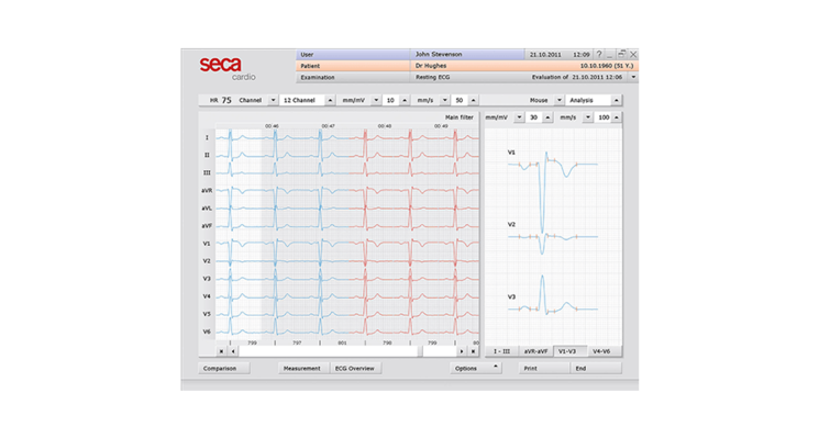 SECA CT320 Interpretive PC ECG with USB connectivity (Discontinued)
