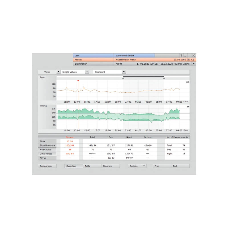 Seca Screen 300 ABPM with Software